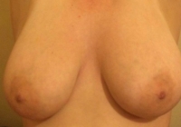 Gallery thumbnails