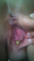 Feature Member