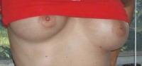 Gallery thumbnails