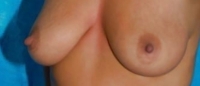 Gallery thumbnails