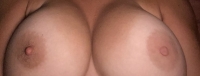 Gallery thumbnails