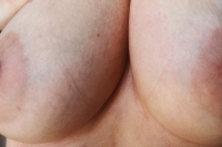 Gallery thumbnails