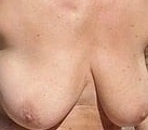 Gallery thumbnails
