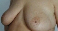 Gallery thumbnails