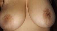 Gallery thumbnails