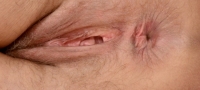Gallery thumbnails