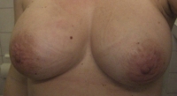 Feature Member