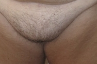 big-big