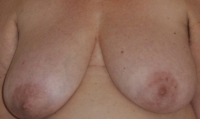 Gallery thumbnails