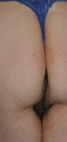 Gallery thumbnails
