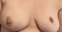 Gallery thumbnails