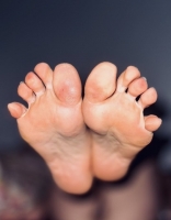 Gallery thumbnails