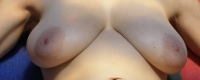 Gallery thumbnails