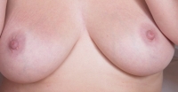 Gallery thumbnails