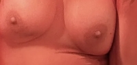 Gallery thumbnails